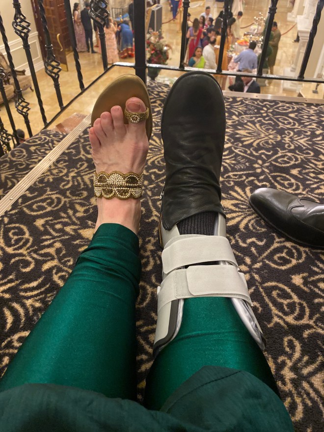 A torn tendon kept me from dancing